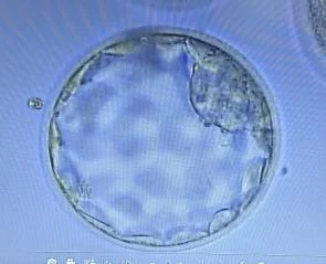 Blastocyst Development