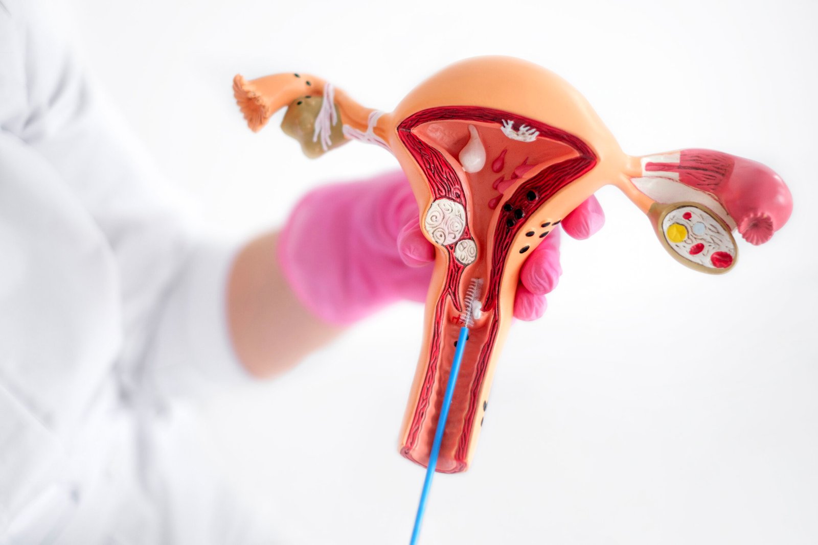 Hysteroscopy