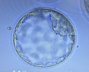 figure 2 A BLASTOCYST