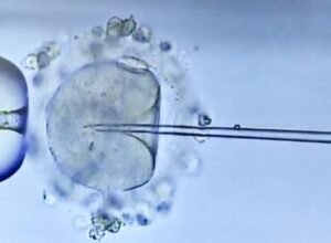 male factor infertility